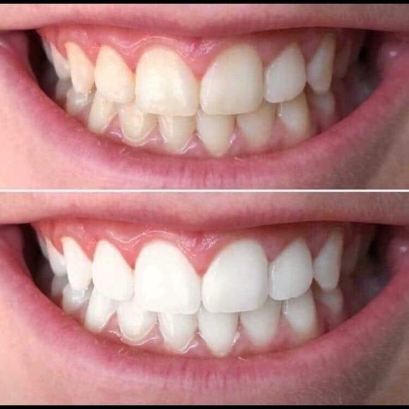Whitening toothpaste! - Picture 3 of 11